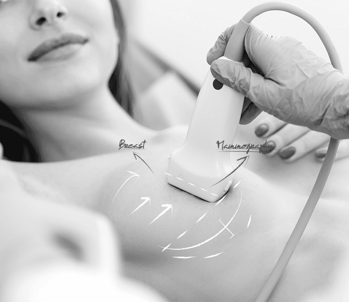 U&Uの乳がん超音波検診 — 超音波プローブで乳房を確認する様子