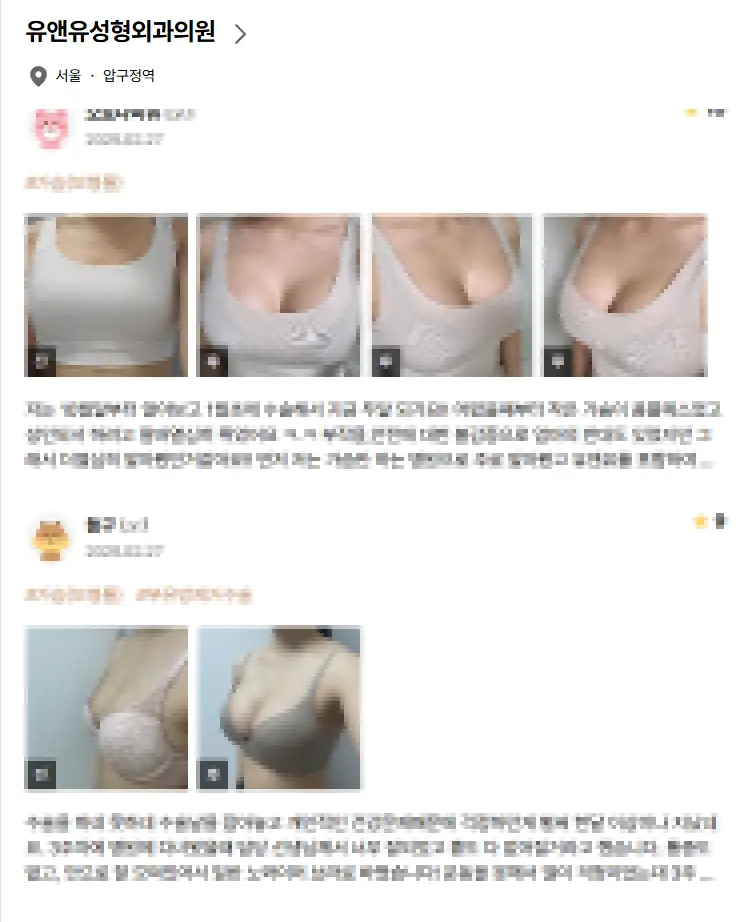 乳房リフト(挙上)手術の費用?先に価格を調べても意味がない理由。 — 本文画像 5