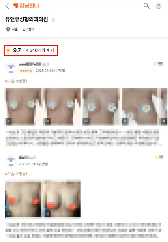 豊胸インプラントの破裂、必ずMRIを撮るべき?超音波で検査できるのではないか — 本文画像 2