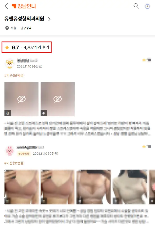 左右非対称バストの補正?インプラント手術で左右差は揃えられる?<402名の研究事例から見る注意点> — 本文画像 2