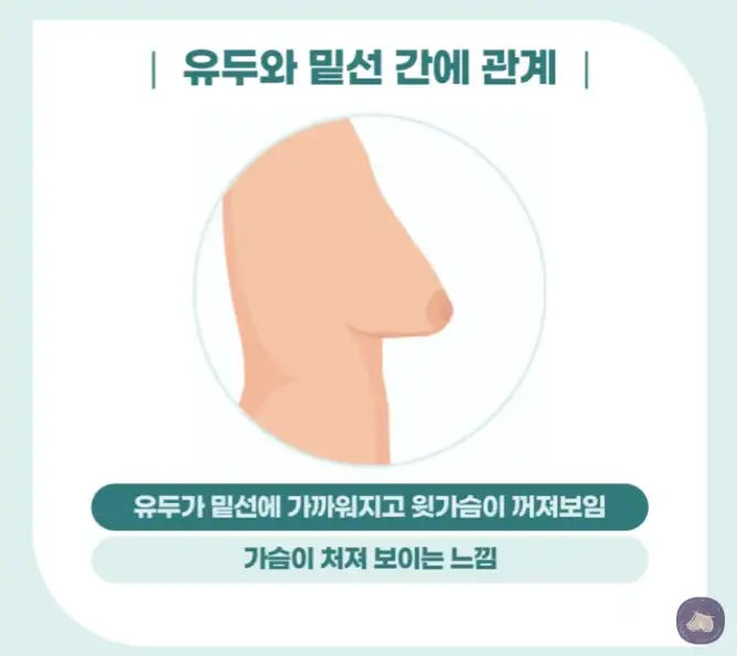 バストリフト(乳房固定術)の費用・価格は?昨年だけで胸のインプラント手術3023件のクリニックがお伝えします。 — 本文画像 5