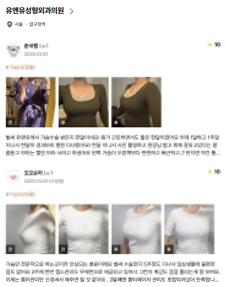 乳房リフト(挙上)手術の費用?先に価格を調べても意味がない理由。 — 本文画像 7