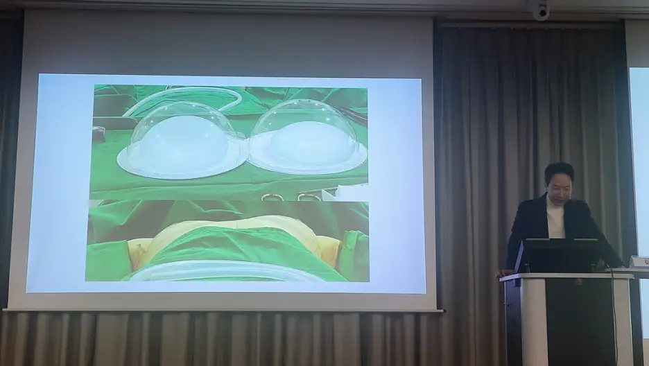 豊胸Preservé、手術の流れ/副作用は?2編の論文をもとにアドバイスいたします。 — 本文画像 7
