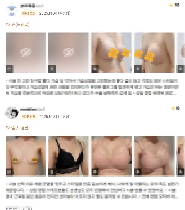 狎鴎亭(アックジョン)のバスト整形外科、執刀医の口コミだけを見て訪問すればよいという誤解 — 본문 이미지