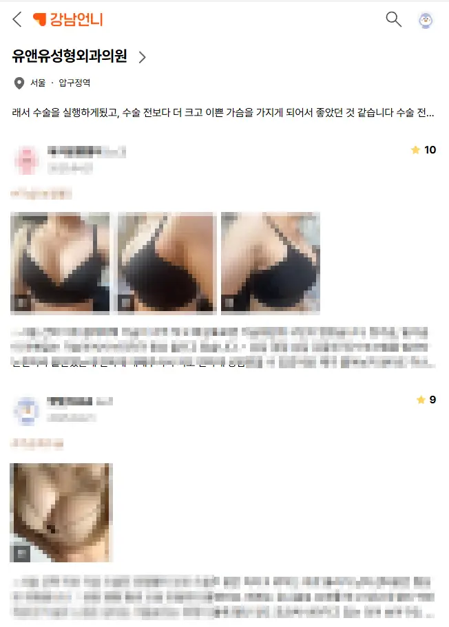 豊胸手術後のたるみ、インプラントも入っているのに、もっとひどくなるのでは? — 本文画像 2