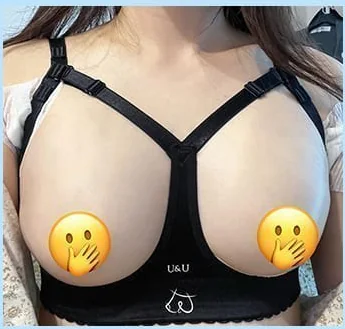 バスト手術2日目、補正ブラ着用の正面写真1