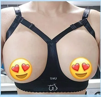 バスト手術2日目、補正ブラ着用の正面写真6