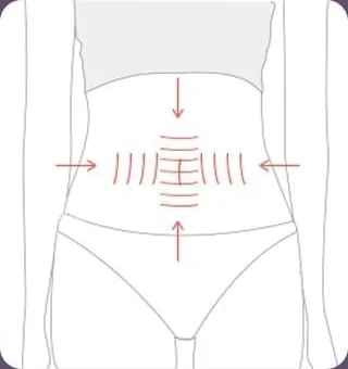 たるんだ皮膚を切除した後、縦横二重の腹筋形成を示した図解
