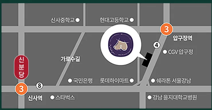 U&U美容外科クリニックの地図 — 狎鴎亭駅4番出口から徒歩5分、カロスキル近く