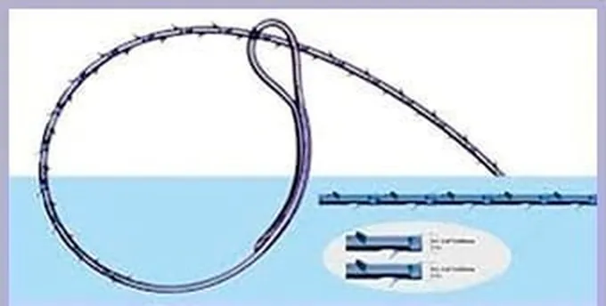 V-Loc縫合糸
