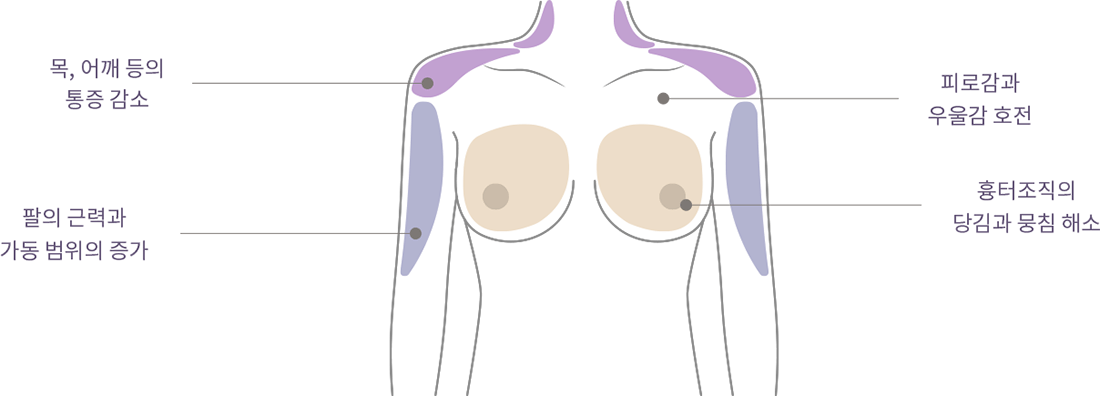 happy breast ピラティス img3